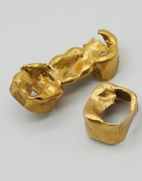 Lot 35 - Or dentaire